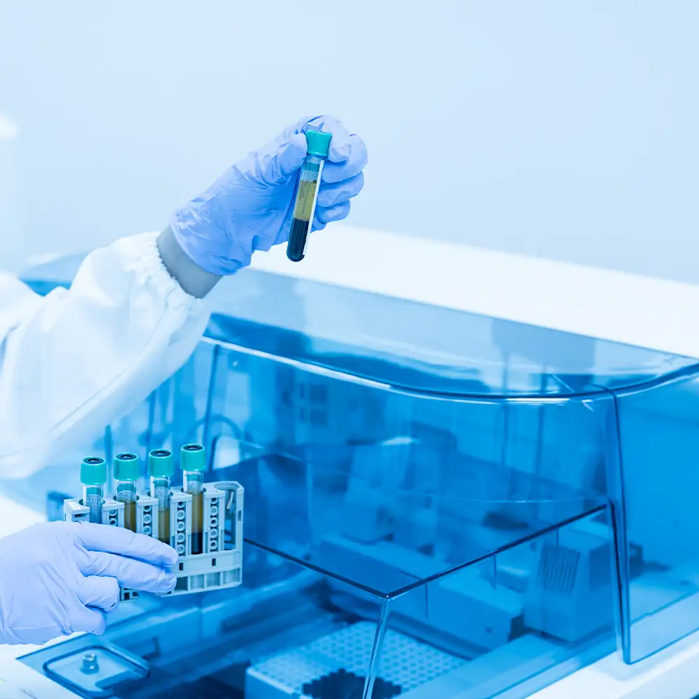 Nahaufnahme der Hand eines Wissenschaftlers mit blauen Handschuhen, der Blutteströhrchen mit einer automatischen Maschine im Labor hält.