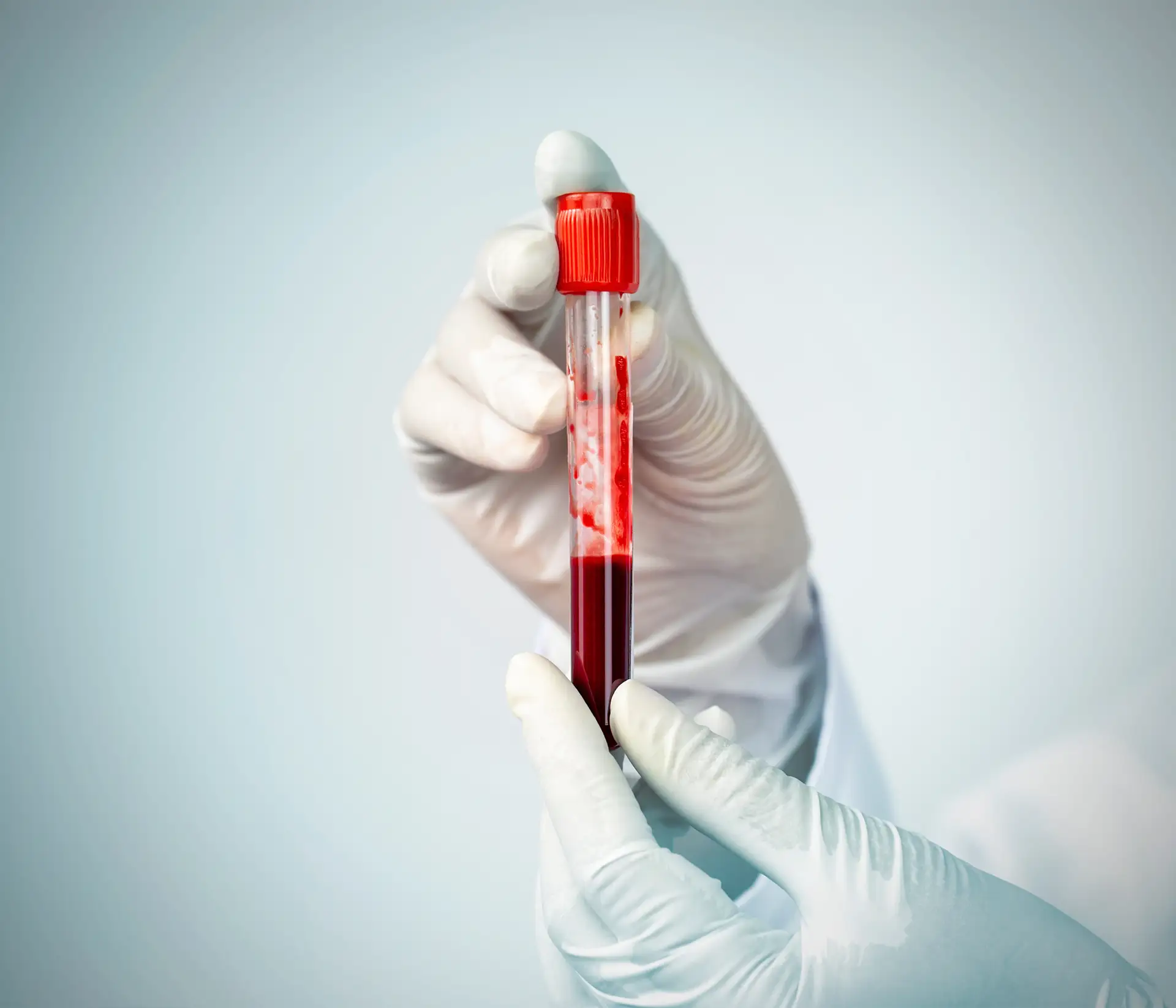 Arzt hält Blutentnahmeröhrchen in der Hand im Hämatologielabor
